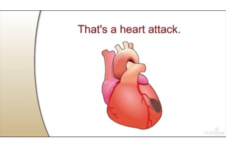 How a Heart Attack Happens