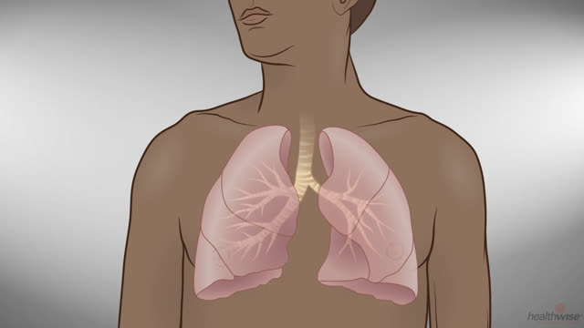 Asthma: What Happens in Your Lungs