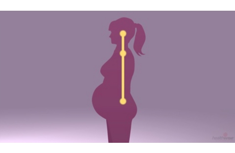 Embarazo: Cómo aliviar el dolor de espalda
