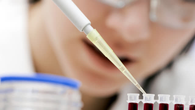 HIV: Understanding the Test