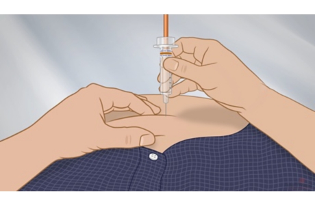 Cómo aplicarse una inyección de heparina (subtitulado)