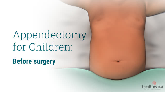 Apendicectomía para niños: Antes de la cirugía