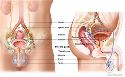 Anatomy of the male reproductive and urinary systems; drawing shows front and side views of ureters, lymph nodes, rectum, bladder, prostate gland, vas deferens, penis, testicles, urethra, seminal vesicle, and ejaculatory duct.
