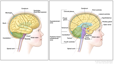 Anatomy of the brain; the right panel shows the supratentorial area (the upper part of the brain) and the posterior fossa/infratentorial area (the lower back part of the brain). The supratentorial area contains the cerebrum, lateral ventricle, third ventricle, choroid plexus, hypothalamus, pineal gland, pituitary gland, and optic nerve. The posterior fossa/infratentorial area contains the cerebellum, tectum, fourth ventricle, and brain stem (pons and medulla). The tentorium and spinal cord are also shown. The left panel shows the cerebrum, ventricles (fluid-filled spaces), meninges, skull, cerebellum, brain stem (pons and medulla) and spinal cord.