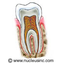 Picture of a tooth (cross section)