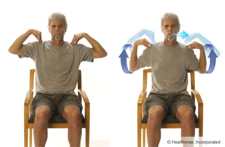 Picture of the elbow-circles exercise for COPD