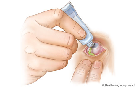 How to put eye ointment in the eye