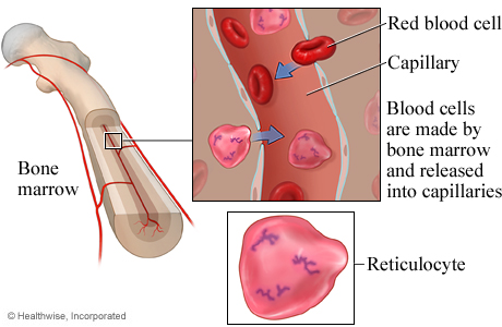 Picture of reticulocytes