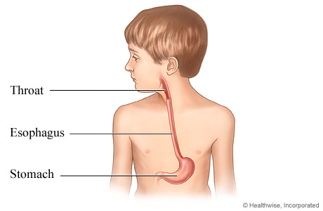 Picture of esophagus in child