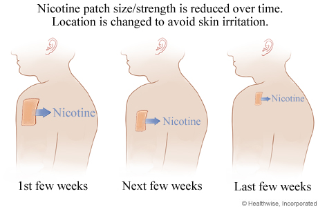 How a nicotine patch is used