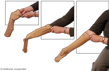 Picture of how to put on compression stockings: Step 1