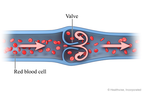 Cross section of vein, showing blood flowing normally through valve