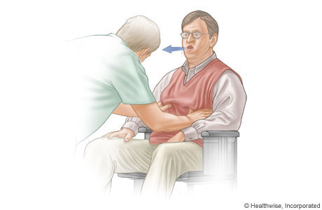 Assisted cough for a person who is obese