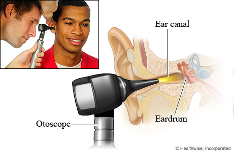 Pictures of the position of an otoscope for an ear exam