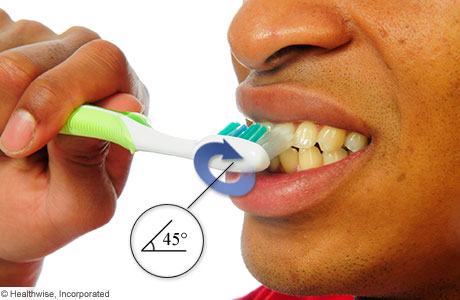 Holding a toothbrush at a 45-degree angle