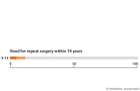 Out of 100 people who have hip replacement surgery, 5 to 12 will need to repeat the surgery within 10 years.