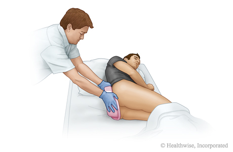 With the person on his or her side, place the bedpan against the buttocks and have the person roll back onto the bedpan