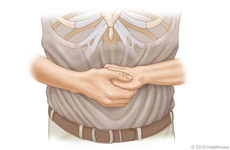 Picture A: Front view of position of hands for Heimlich maneuver in an adult or child