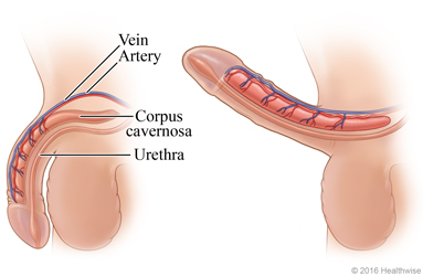 Side view of flaccid penis and erect penis, showing changes in major blood vessels and corpus cavernosa during an erection