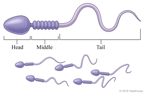 A group of sperm, with detail of a single sperm