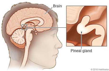 Location of pineal gland in brain, with close-up of pineal gland