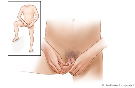 How to do a testicular self-examination