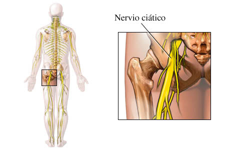 Imagen del nervio ciático y su localización en el cuerpo