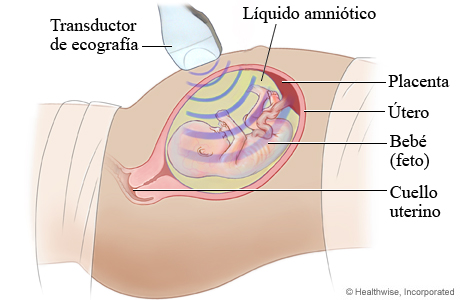 Imagen de una ecografía fetal