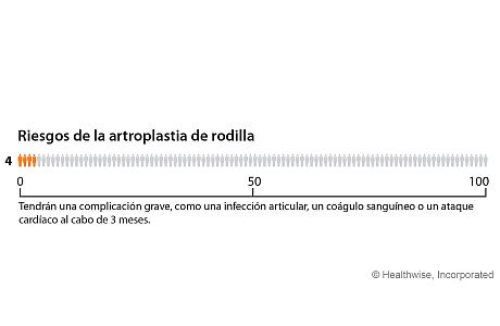 De cada 100 personas que se someten a una artroplastia de rodilla, 4 tendrán una complicación grave, como una infección articular, un coágulo sanguíneo o un ataque cardíaco al cabo de 3 meses.