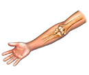 Icon indicating an example of medical illustration